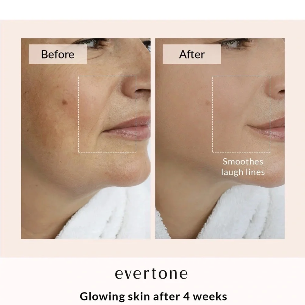 Great used condition, Evertone OMNIGLOW LED FACE & Neck mask. 7 LED colors - Picture 8 of 12